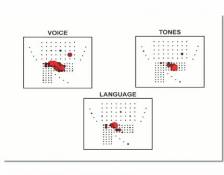 ECoG video article in Journal of Visualized Experiments